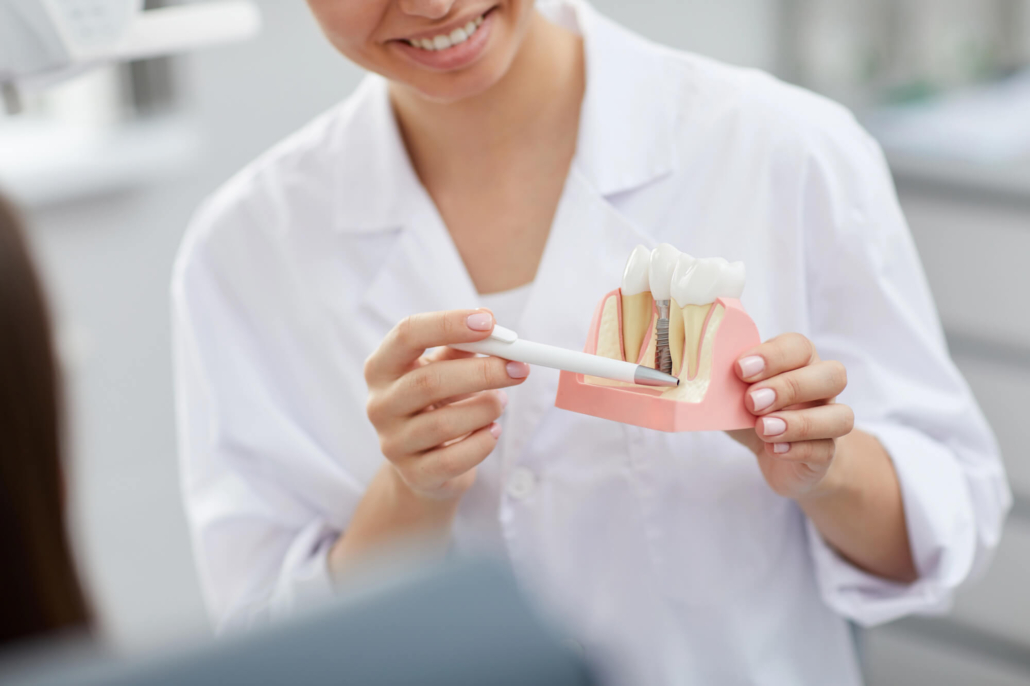 dentist explaining hollywood dental implants procedure